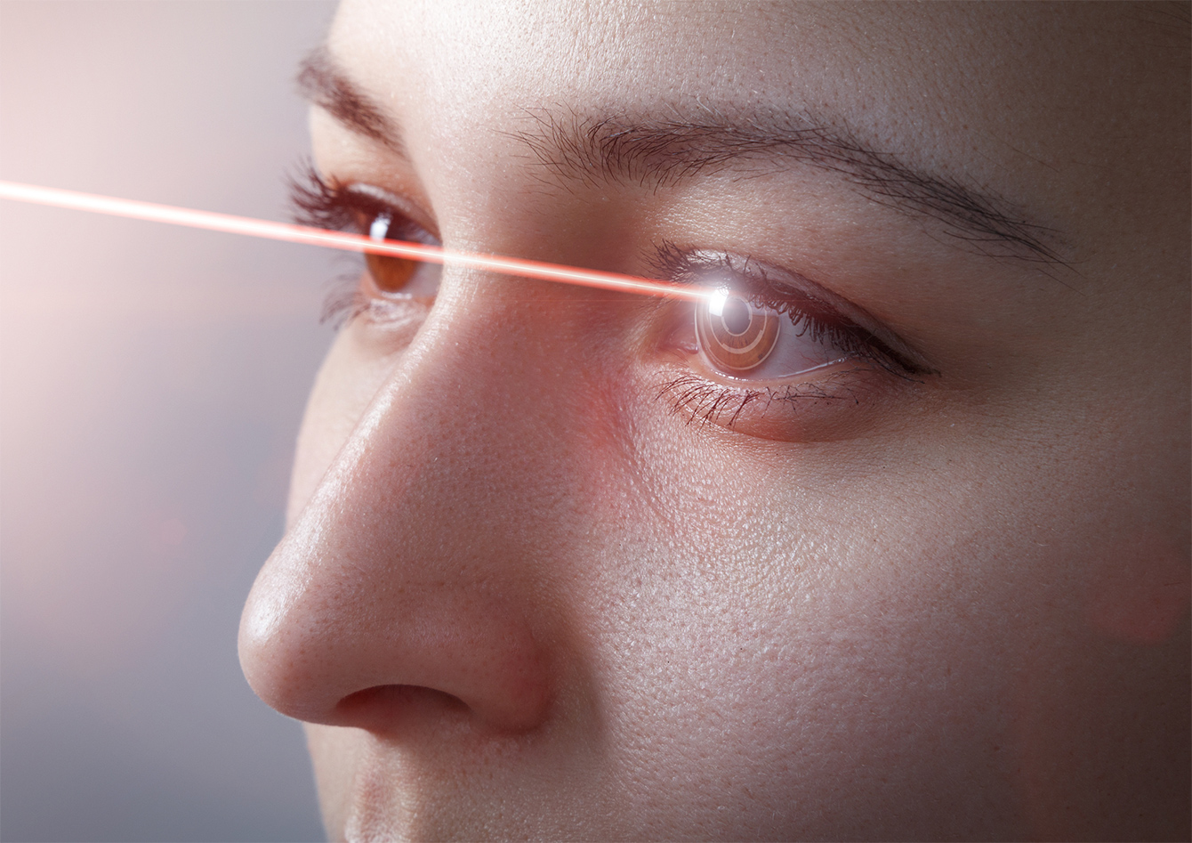 Selective Laser Trabeculoplasty